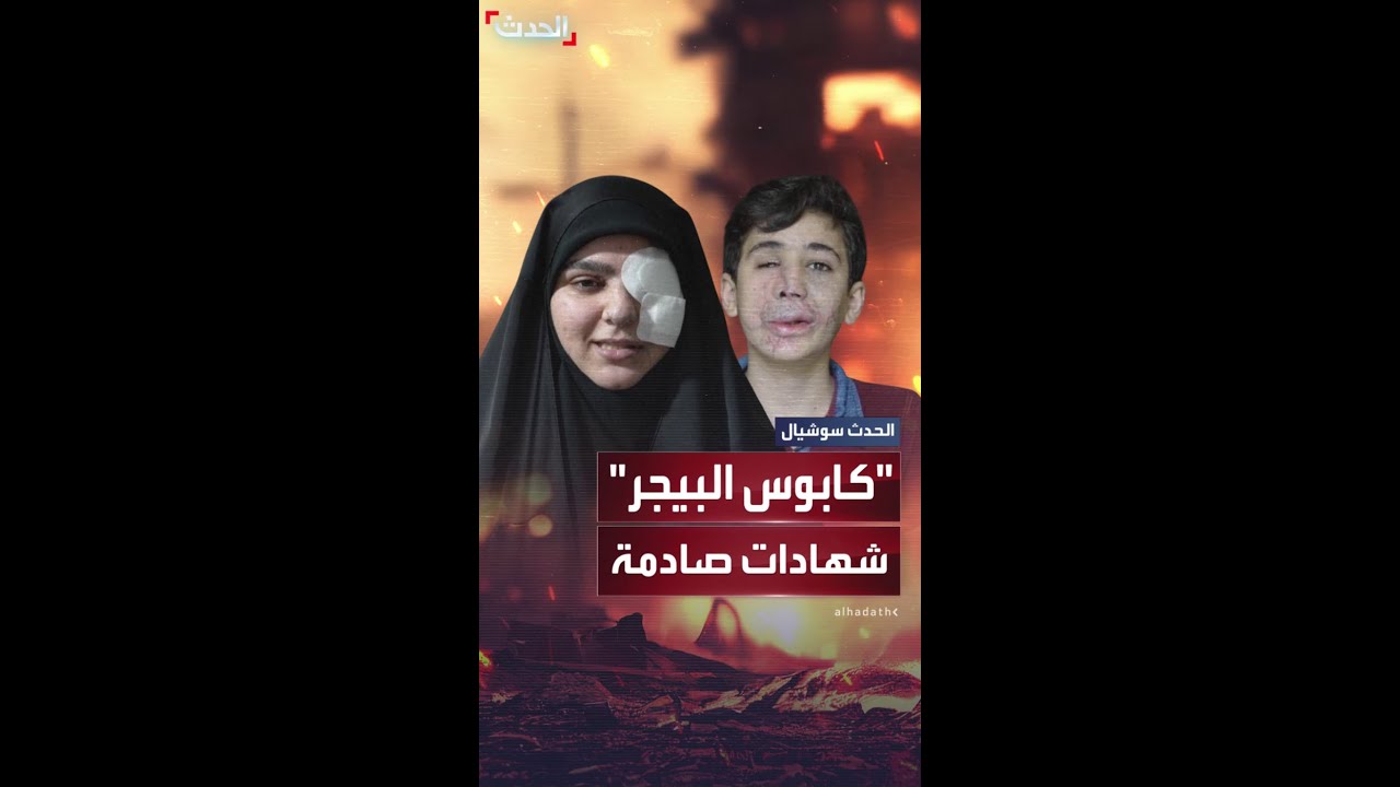 تقرير أسوشيتد برس يكشف: من انفجرت بيدهم أجهزة البيجر لم يعودوا كما كانوا