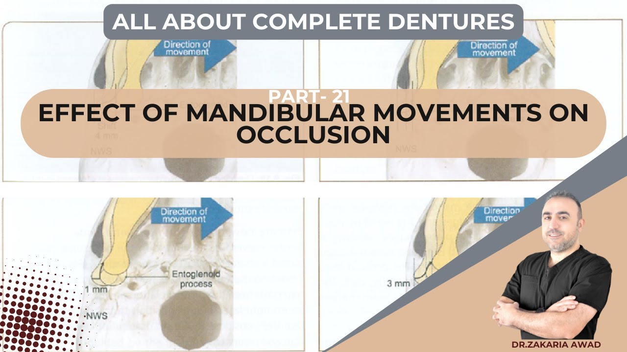 21- تأثير الحركات الفكية على الاطباق - EFFECT OF MANDIBULAR MOVEMENTS ON OCCLUSION