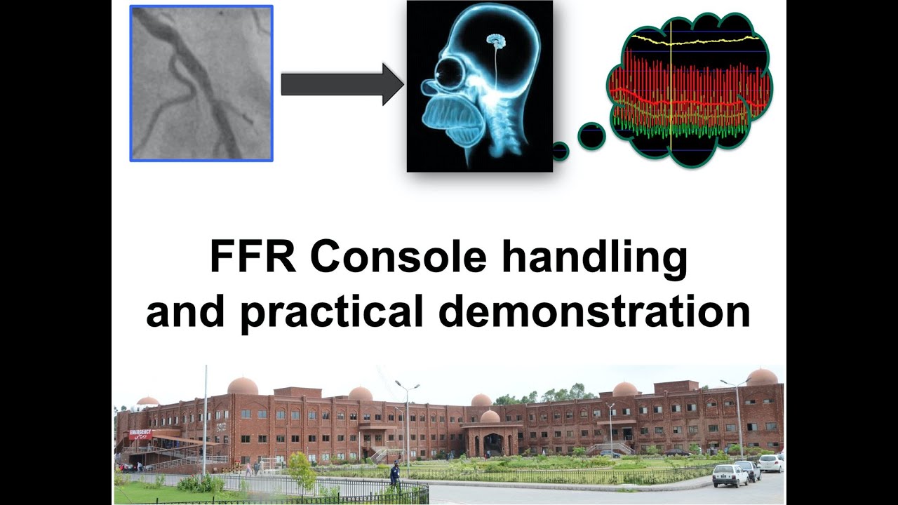 5 FFR console handling and practical demonstration in Coronary Physiology