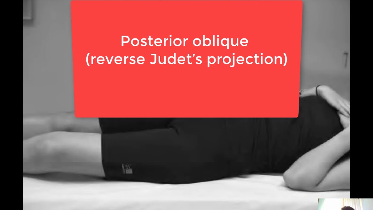 10 Judet&rsquo;s  and reverse Judet&rsquo;s projection