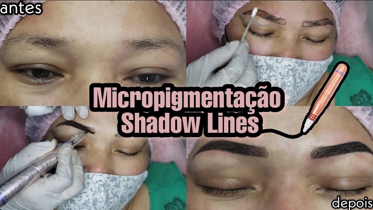 MICROPIGMENTAÇÃO COM DERMÓGRAFO CHARMANT 2