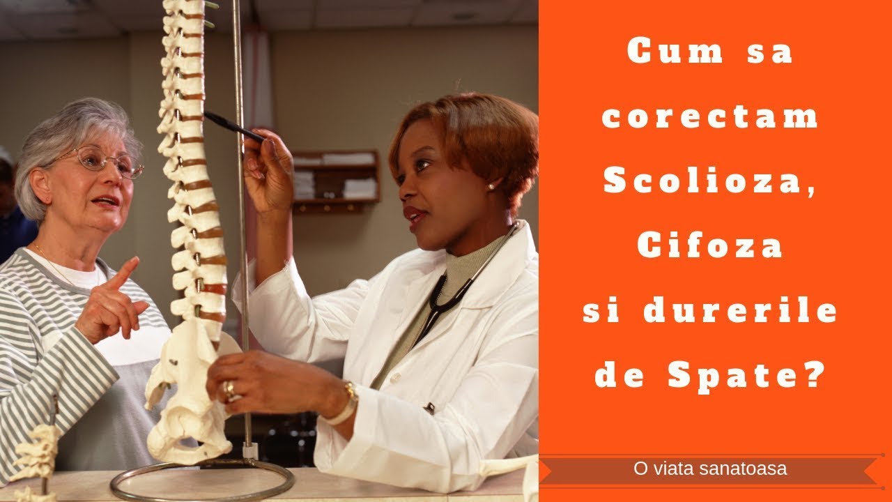 Cum sa corectam Scolioza, Cifoza si Durerile de Spate?
