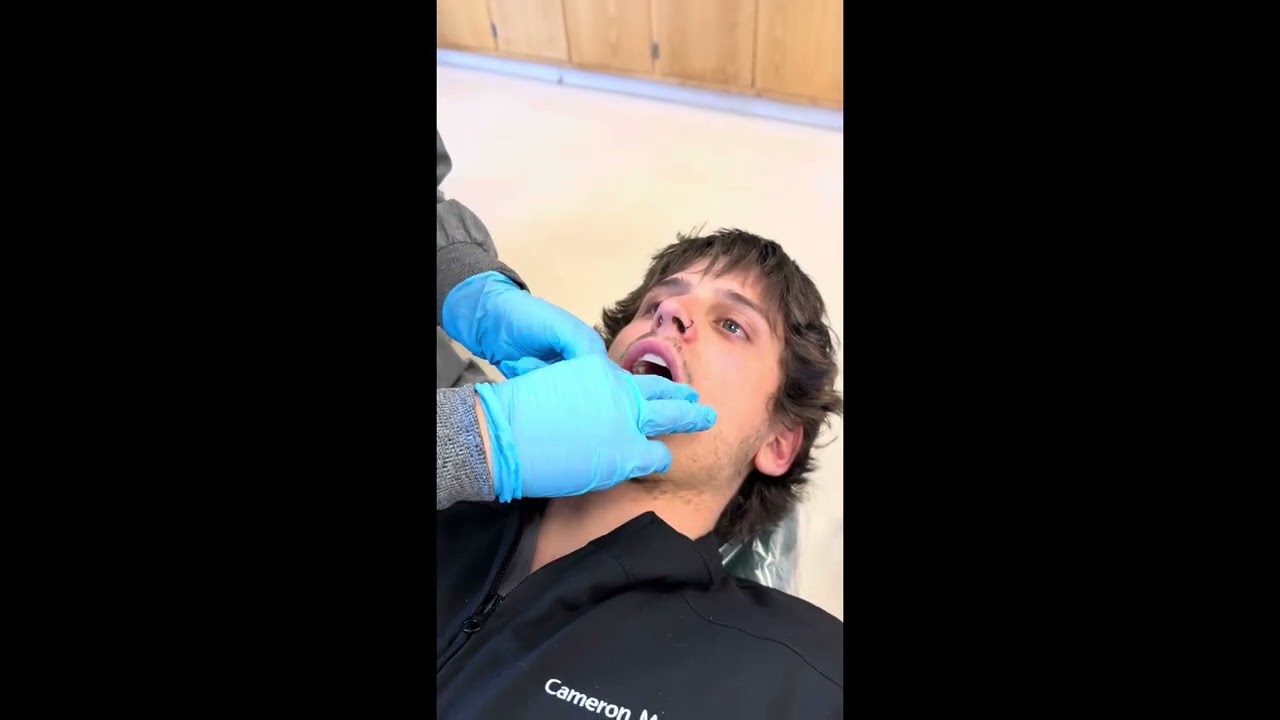 Intra and Extra Oral Exam