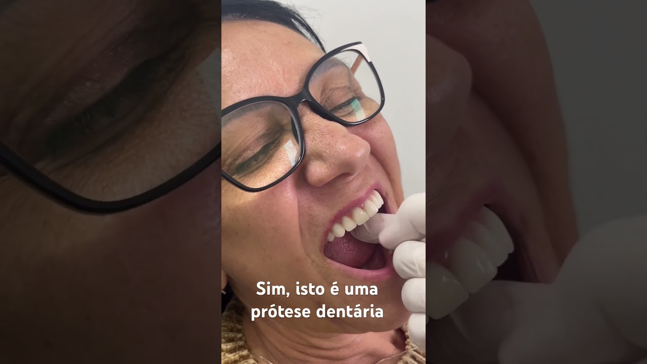 Pr&oacute;tese dent&aacute;ria superior com protocolo inferior