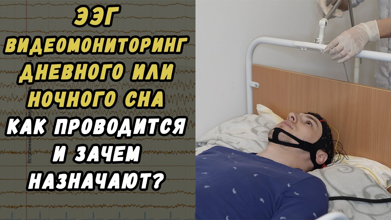 ЭЭГ видеомониторинг в Хабаровске