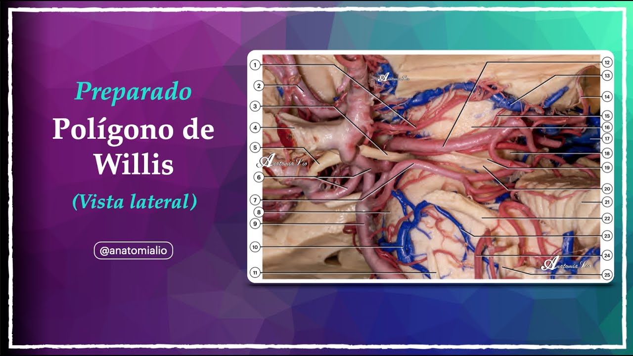 🧠 Arterias y nervios craneales: razoná el preparado, no memorices