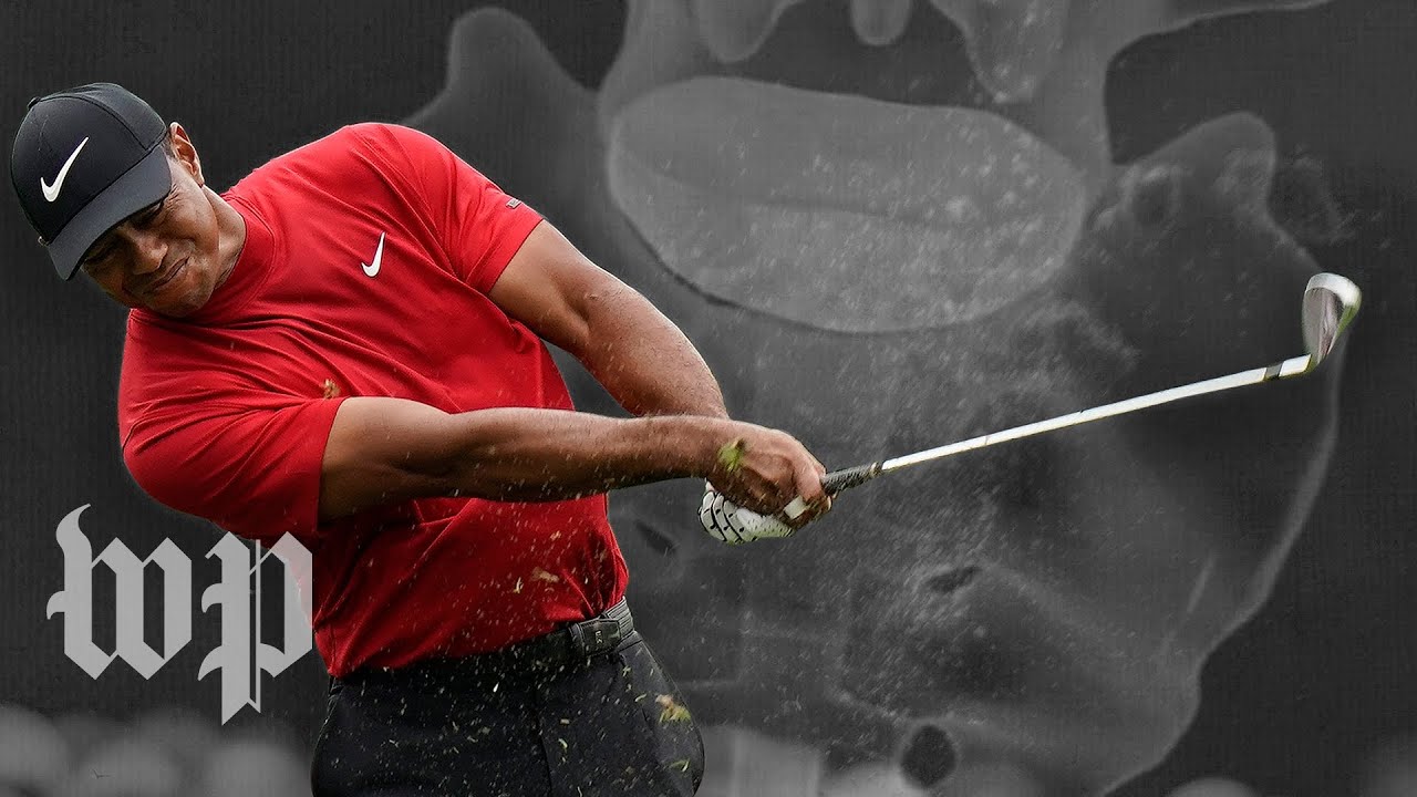 The spinal surgery that made the Tiger Woods comeback a reality