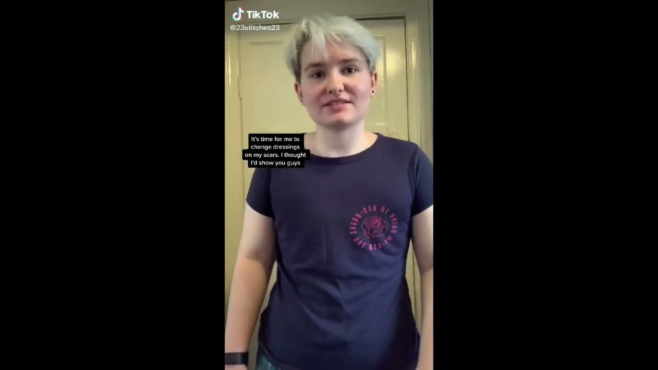 TikTok Top Surgery Mini Vlog Compilation Part 2 (Non-Binary/trans mas)