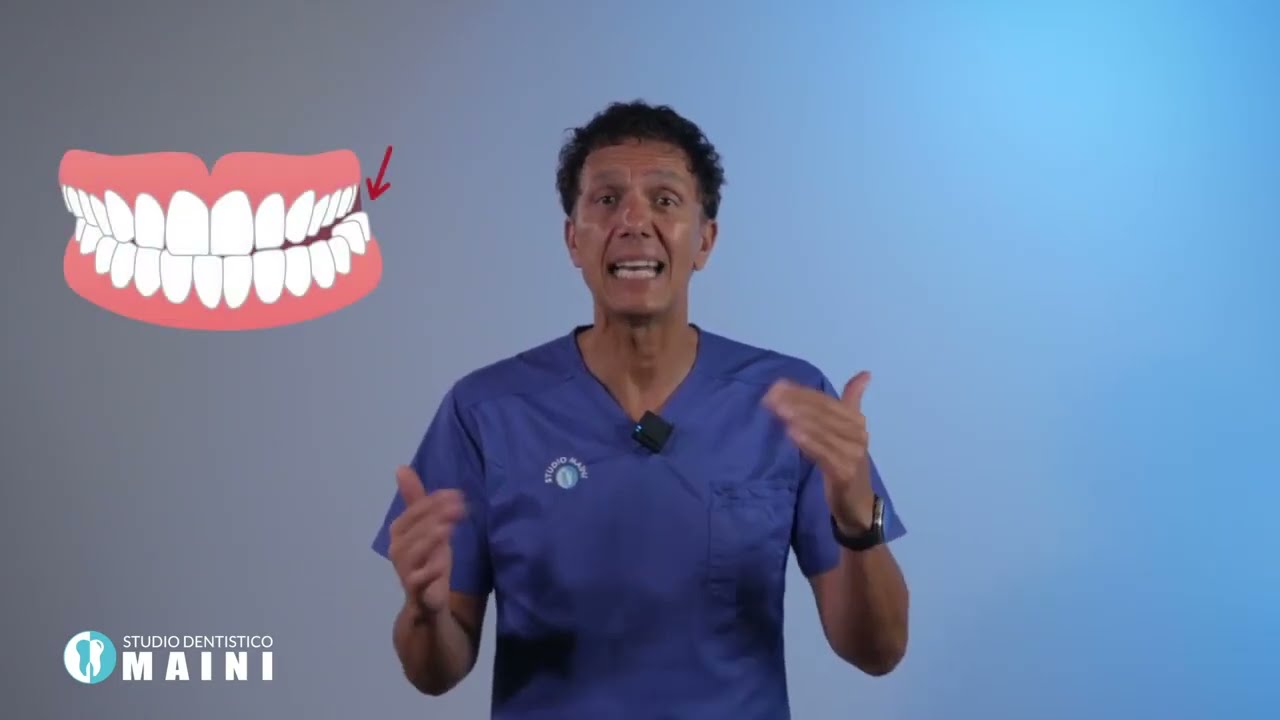 Il morso crociato (cross bite)