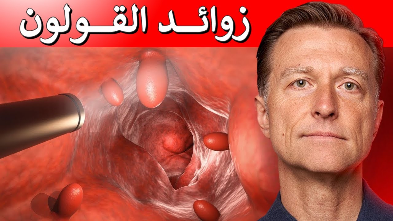ظهور زوائد في القولون ليس أمر طبيعي | أهم نصيحة لمنع البوليبات أو لحميات القولون