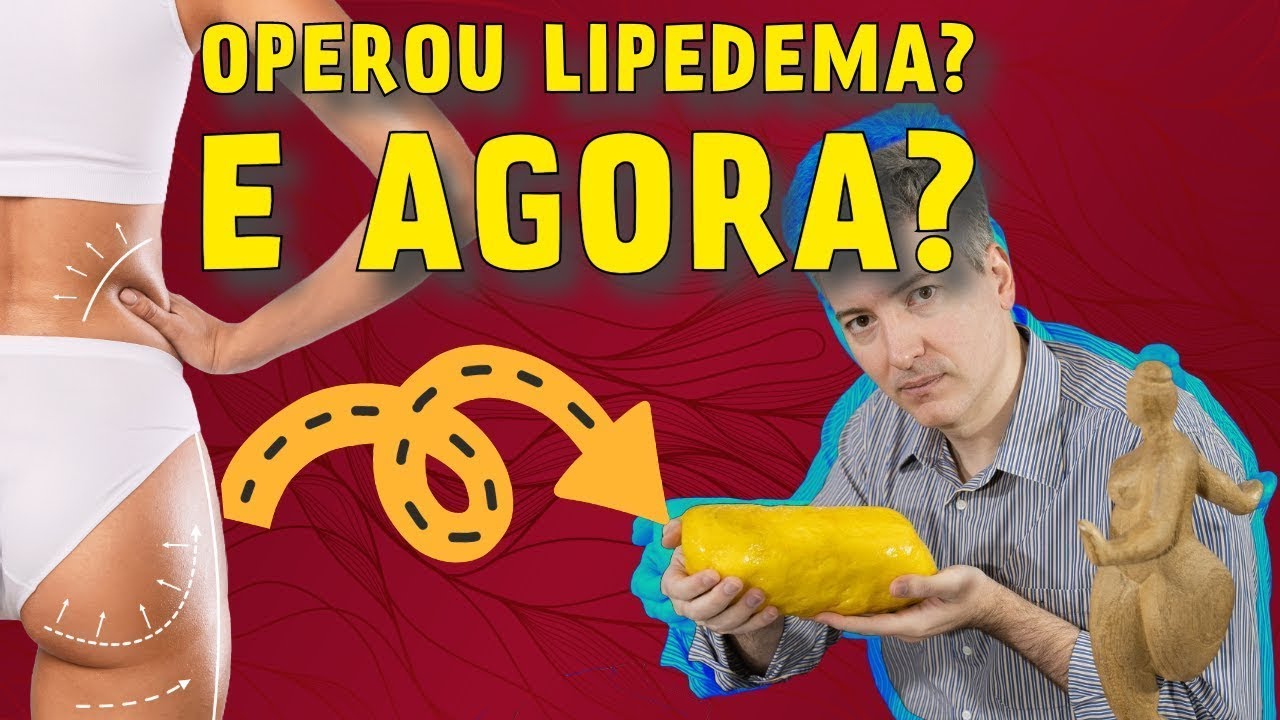 Como é a Vida Após a Cirurgia do Lipedema?