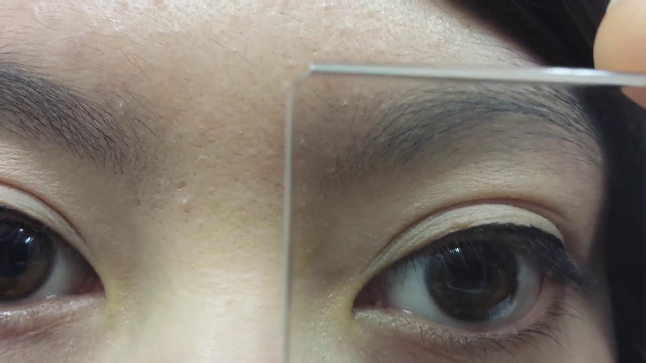Orthoptic Clinical Skills - Assessment of Binocular Vision | Doctor Steve