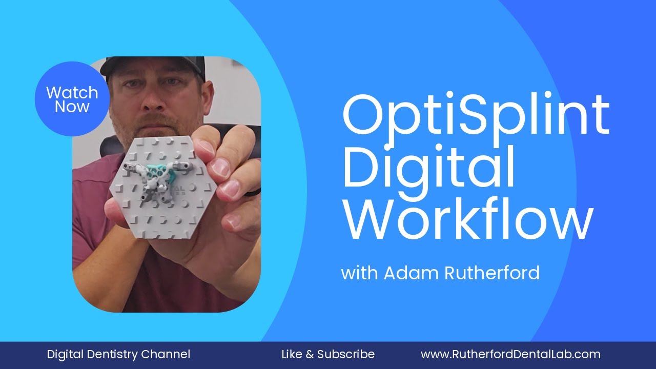 Все на X Digital Arches Optisplint Workflow