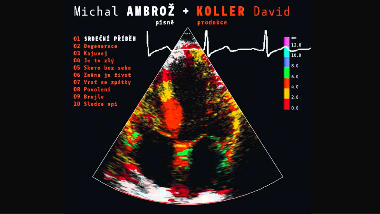 MICHAL AMBROŽ & DAVID KOLLER - Srdeční příběh [Official Audio]