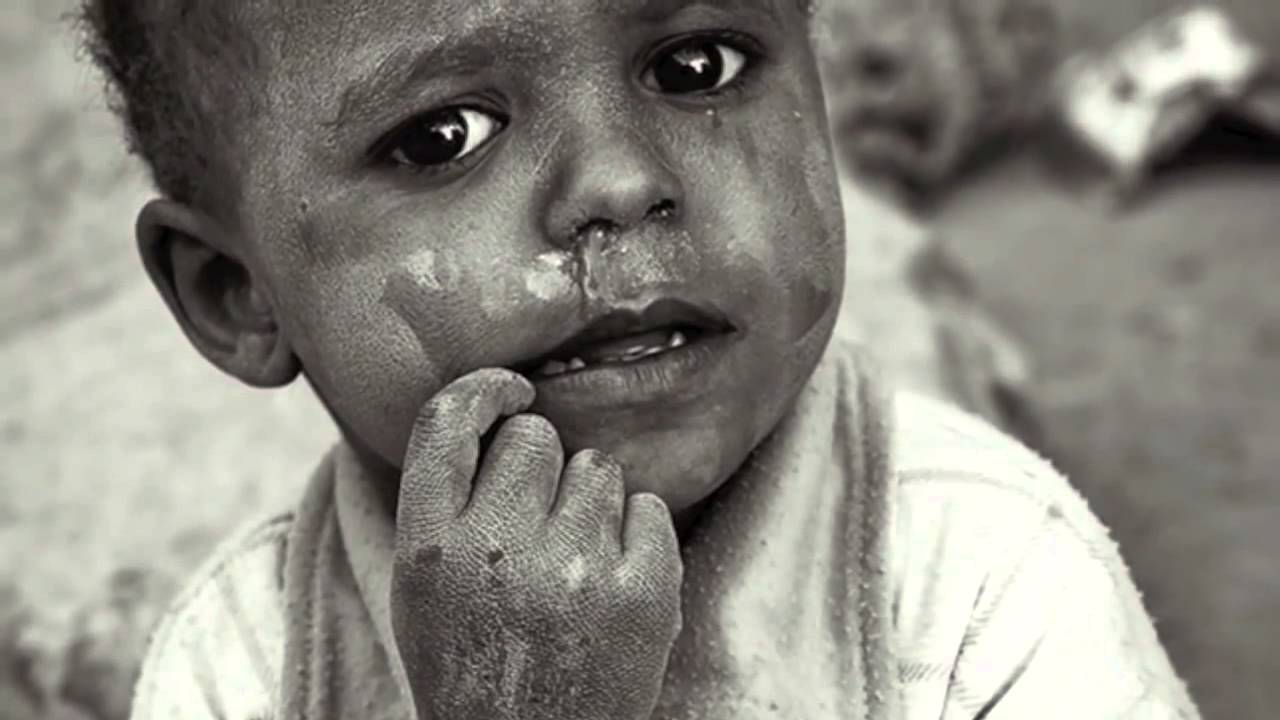 World Hunger  - UNICEF