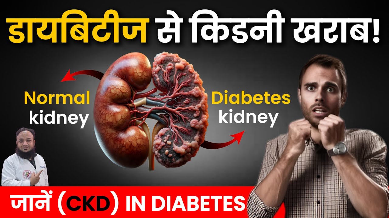 The Silent Killer: How Diabetes Ruins Your Kidneys #chronickidneydisease