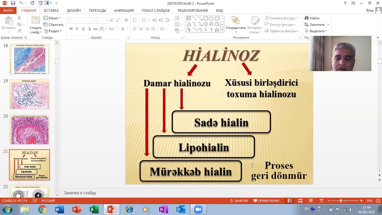 Patologiya-1 - Mühazirə - Mezenximal (stromal-damar) və qarışıq distrofiyalar