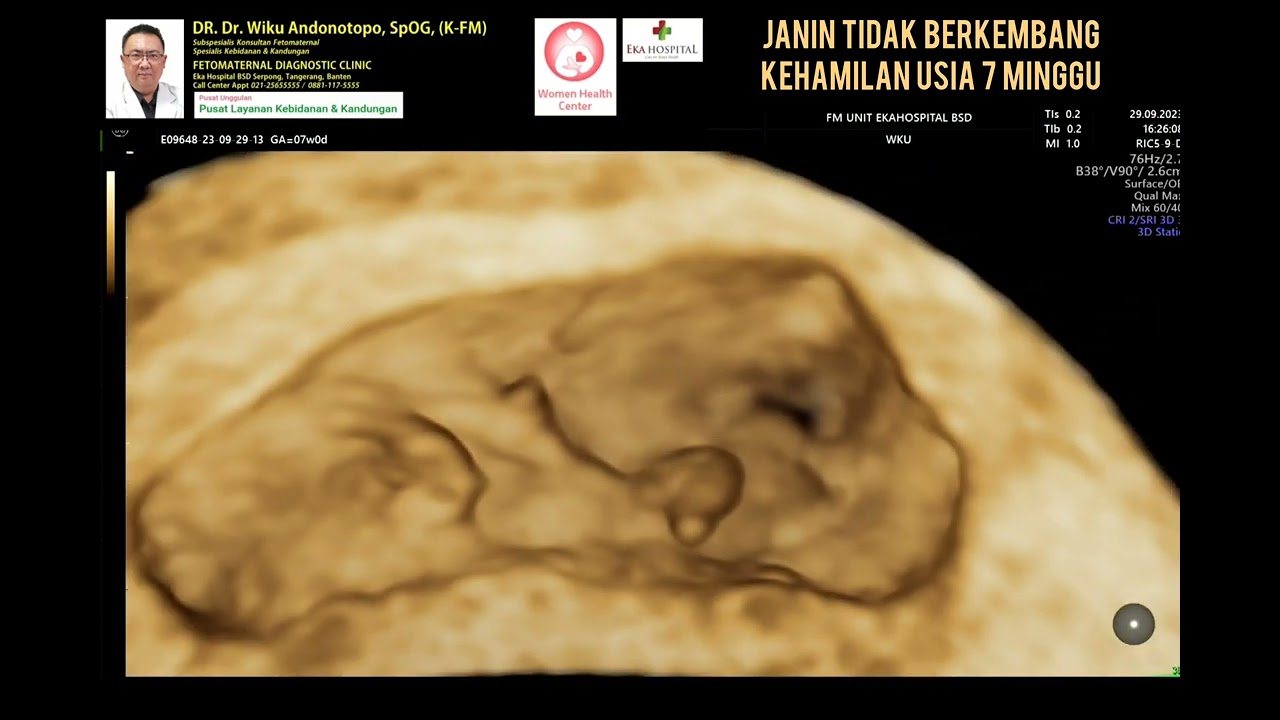 Kehamilan tidak berkembang 7 minggu