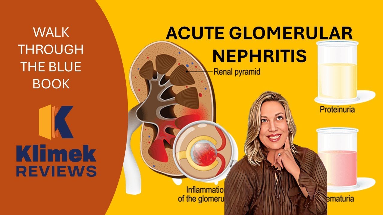 ACUTE GLOMERULAR NEPHRITIS + questions with Dr. Sharon