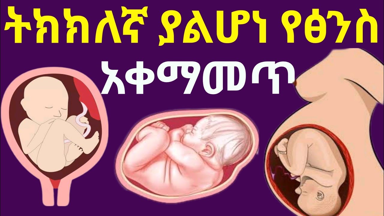 ትክክለኛ ያልሆነ የፅንስ አቀማመጥ | በምን ይከሰታል ? የሚደረጉ ህክምናዎችስ ምንድናቸው ?