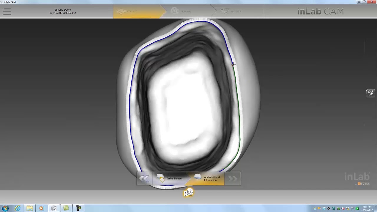 Dental Lab Life: Dentsply Sirona inLab CAM Software