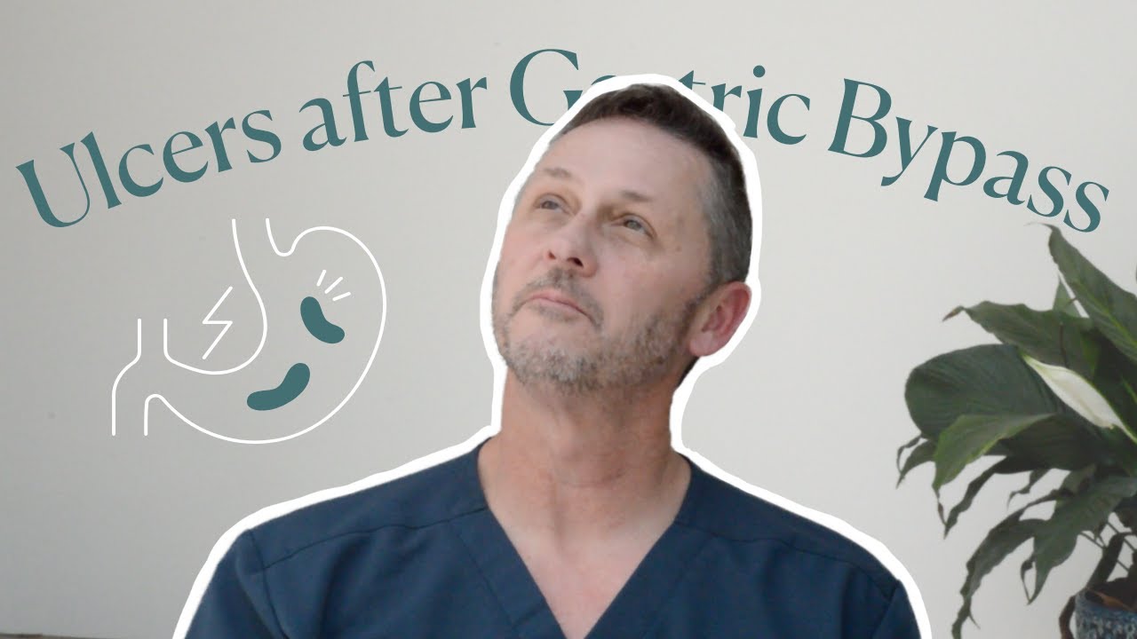 Am I at Risk of Getting Ulcers After my Bariatric Surgery?