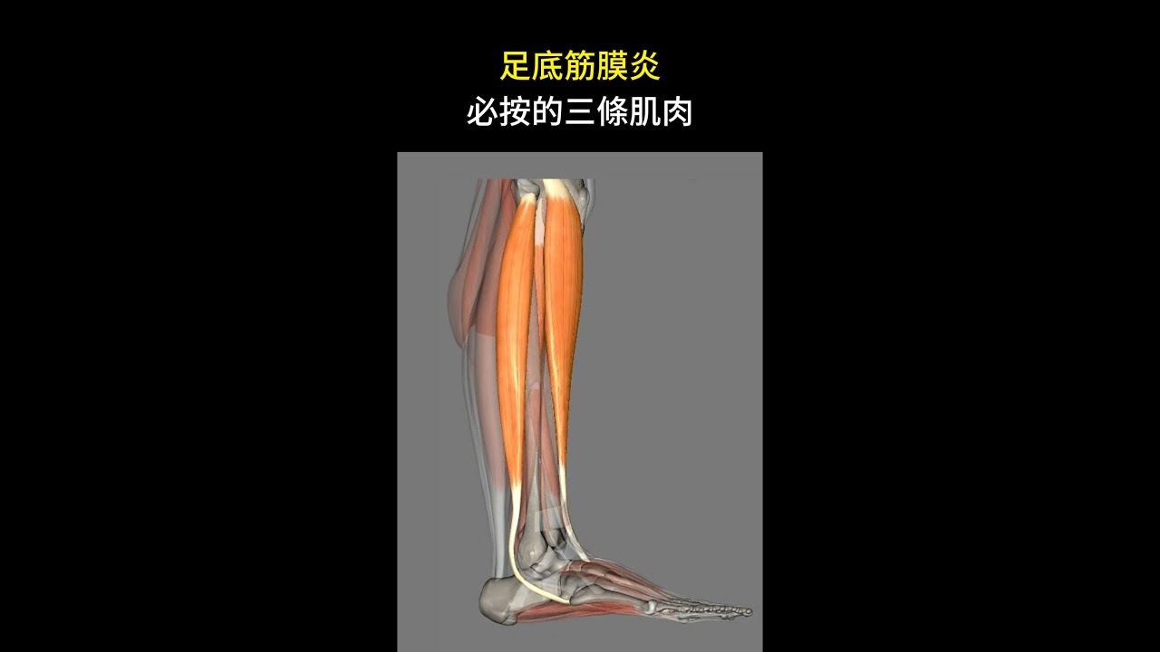 足底筋膜炎腳跟痛？必按這三條肌肉，疼痛明顯減輕
