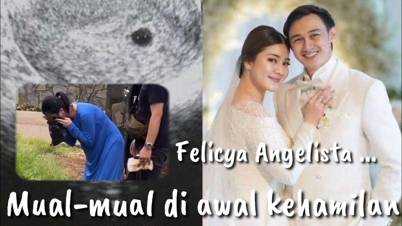 Felicya Angelista Mual-mual pengaruh hamil mudah