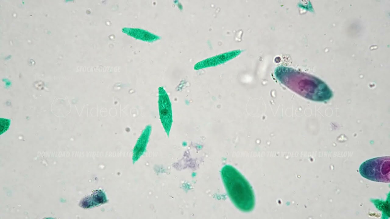 Euglena under microscope with 400 times magnification on bright field background