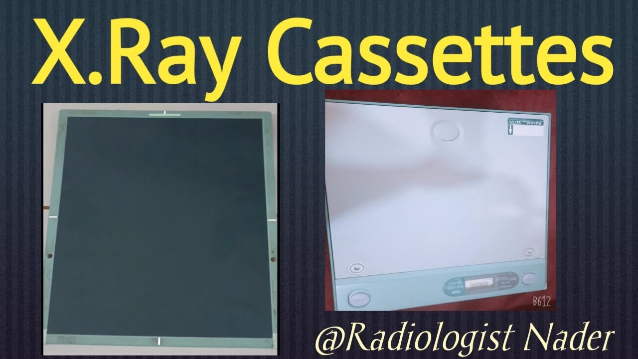 X.Ray Cassettes | كاسيتات الاشعة . #Fuji #agfa #cassettes #X.Ray