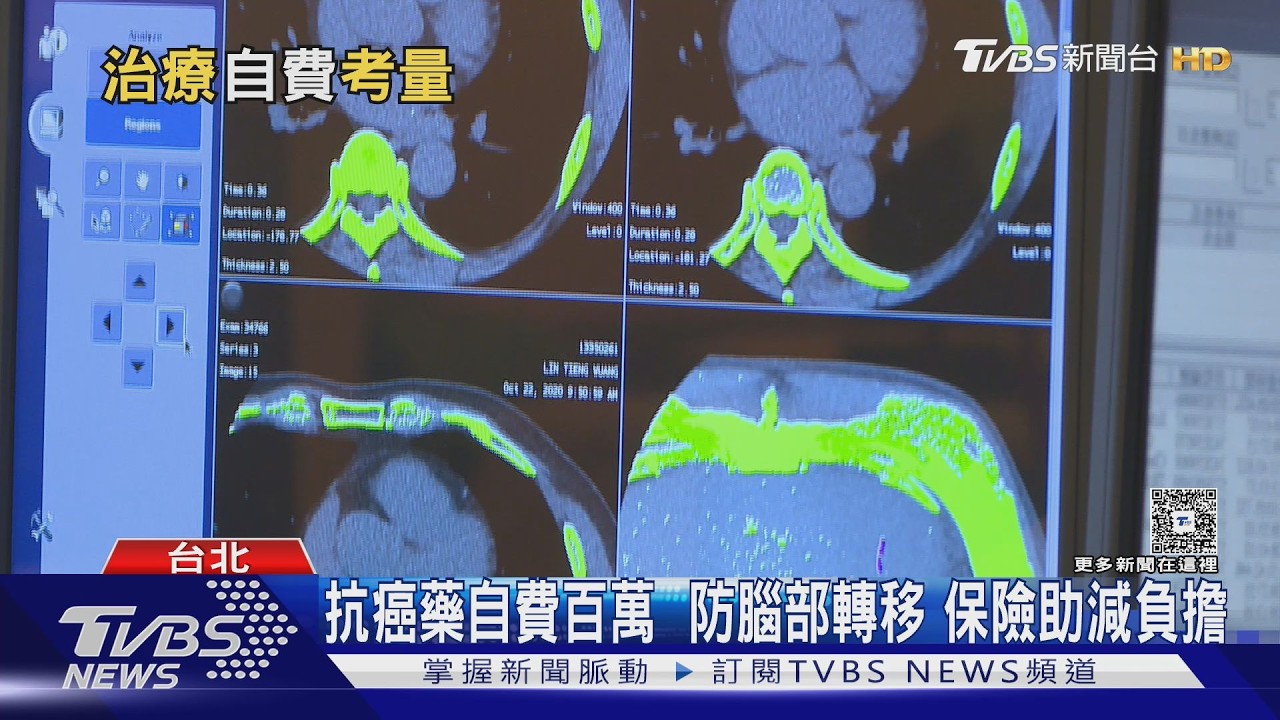 癌症自費藥物該不該用?醫曝關鍵:先問自己「這些事」｜十點不一樣20260212 @TVBSNEWS01