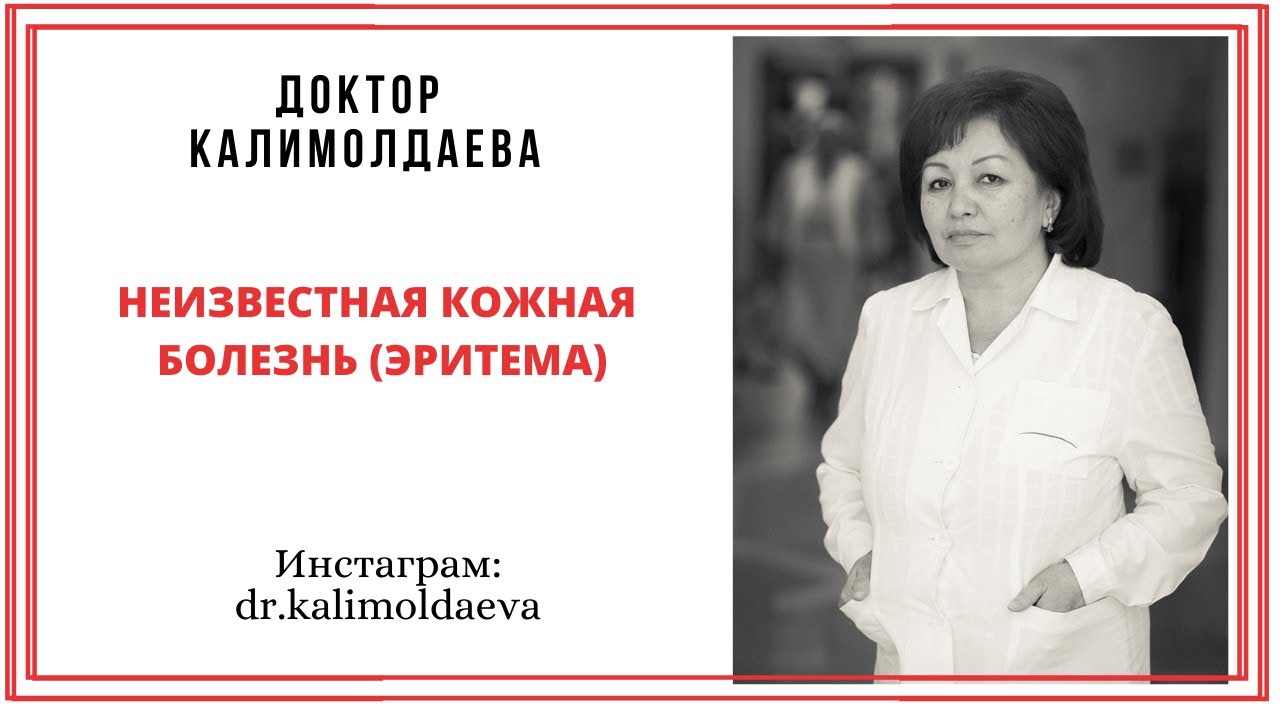 Неизвестная кожная болезнь (эритема)