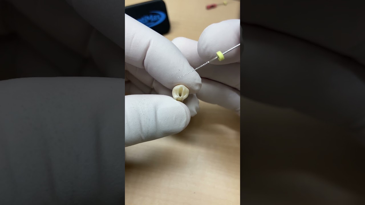 These are tricky teeth