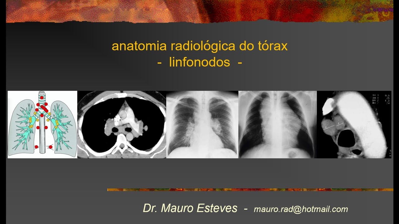 Anatomia - Linfonodos