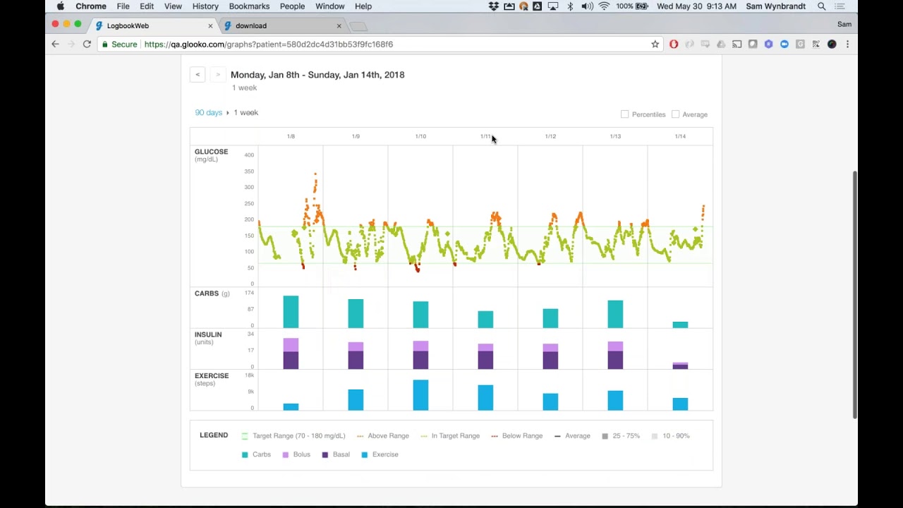 Webinar - Glooko New Reports & Graphs