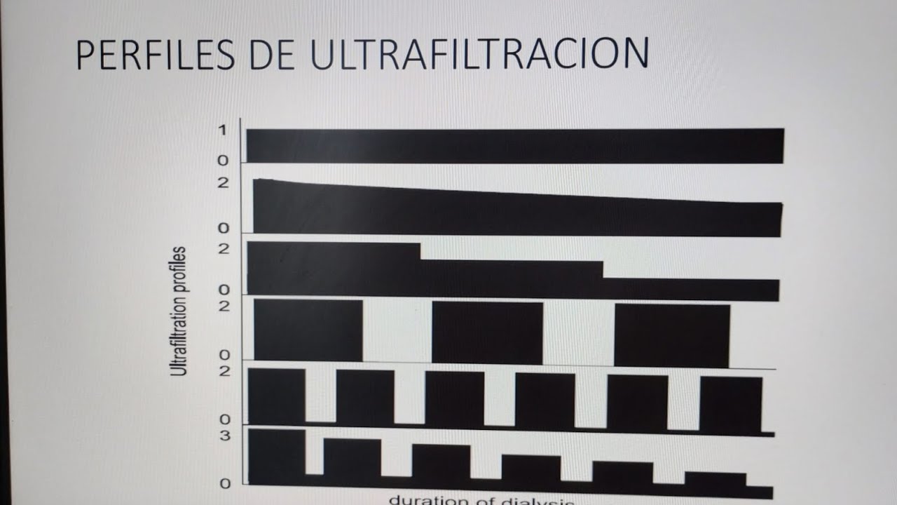 Parámetros a programar en el tratamiento de hemodiálisis.