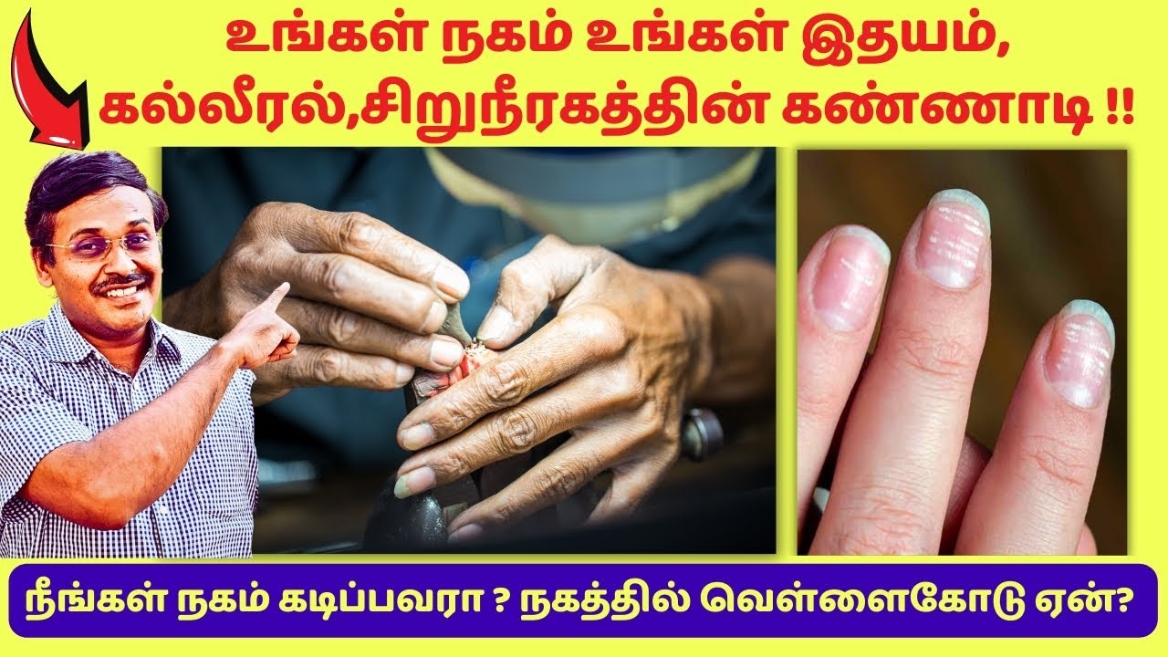 அகத்தின் ஆரோக்கியம் நகத்தில் தெரியும் | 10 nail signs symptoms