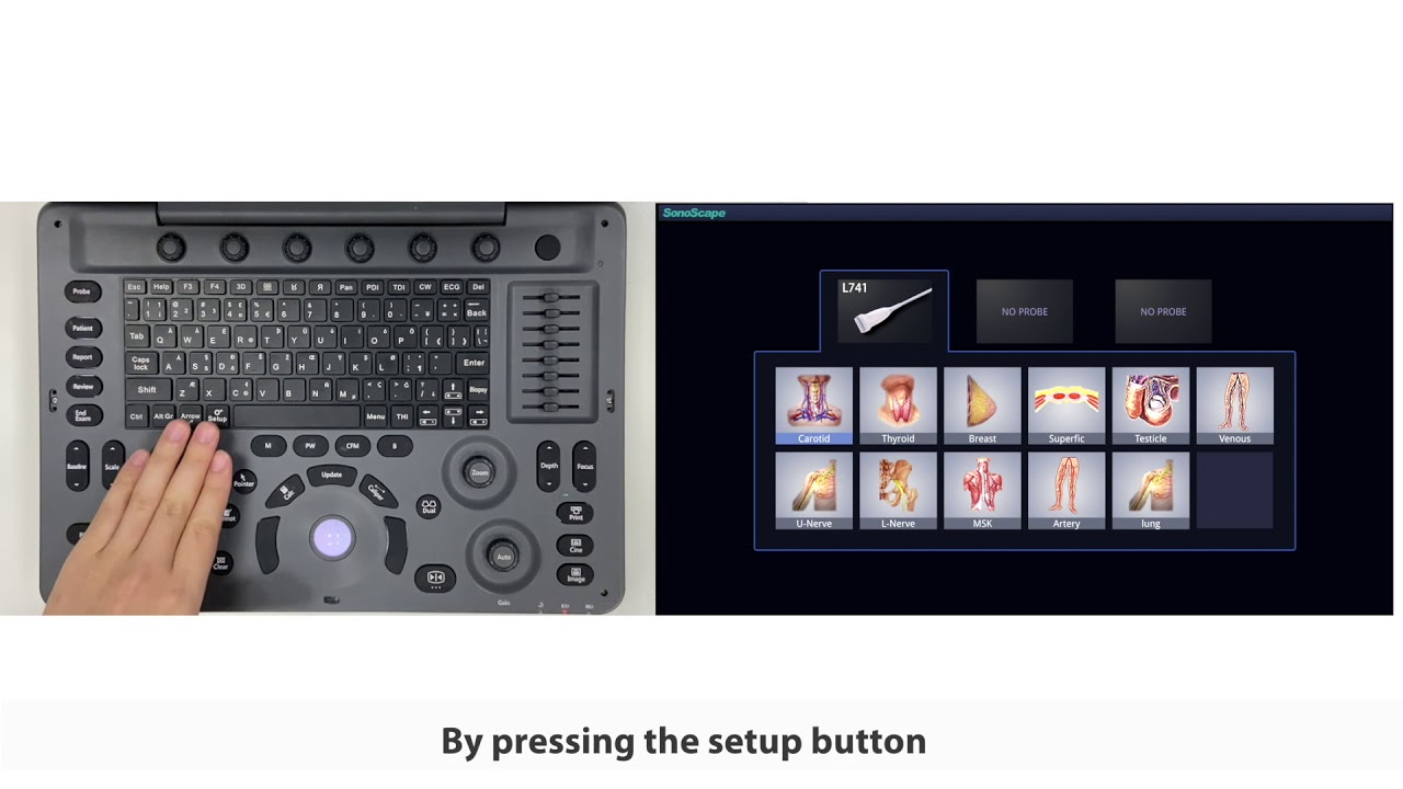 Looking For An Affordable Black & White Ultrasound Machine? Buy SonoScape A6V Expert E1V | KeeboMed