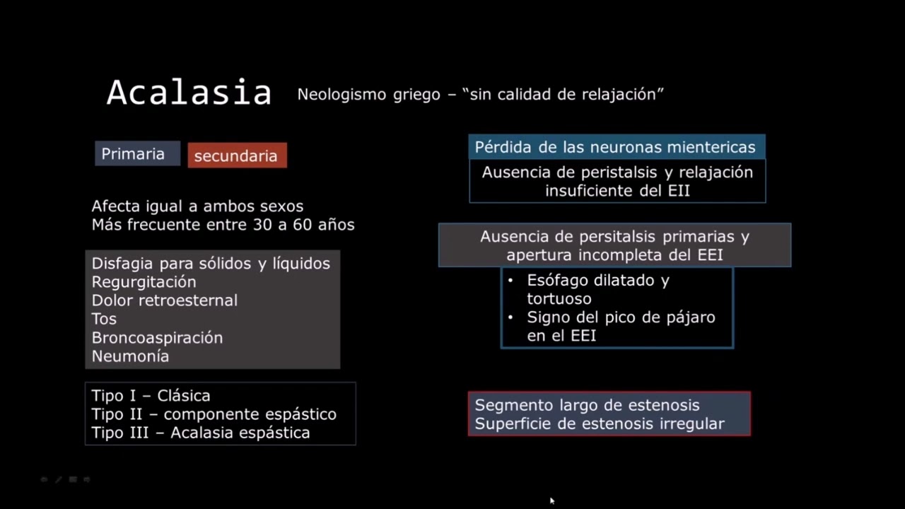 Radiología en 5 minutos: Acalasia.