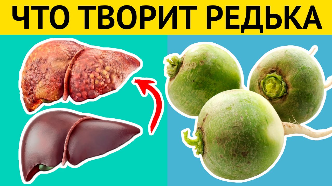 Даже одна долька ЗЕЛЕНОЙ РЕДЬКИ вызывает НЕОБРАТИМЫЕ ПРОЦЕССЫ в организме. Медики шокированы!
