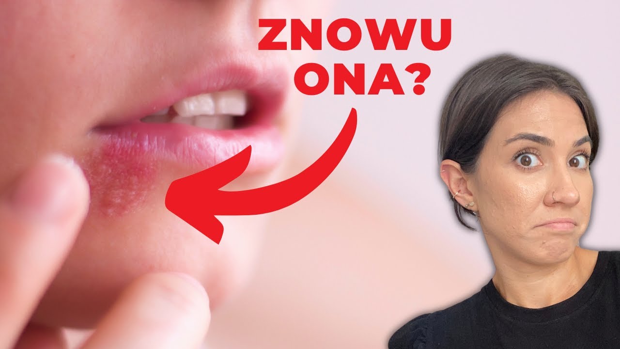 Dlaczego masz opryszczkę?