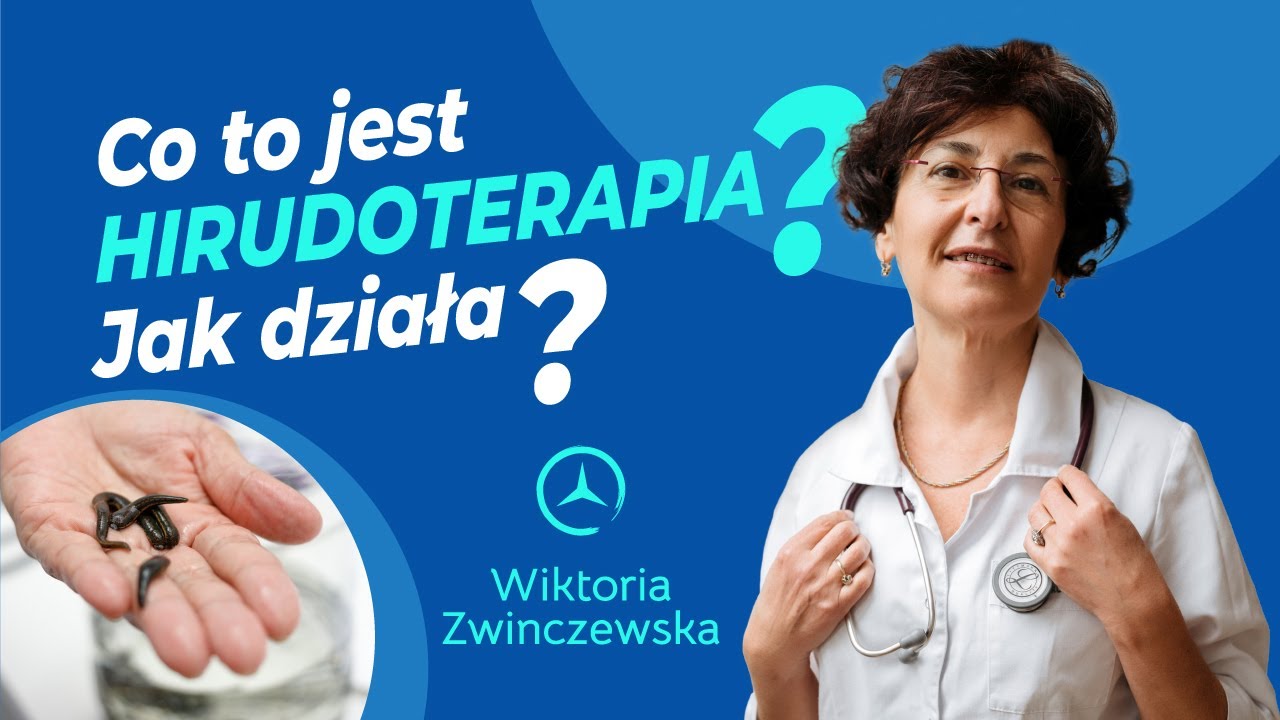 Co to jest Hirudoterapia i jak działa? Na co pomaga Pijawka Lekarska?