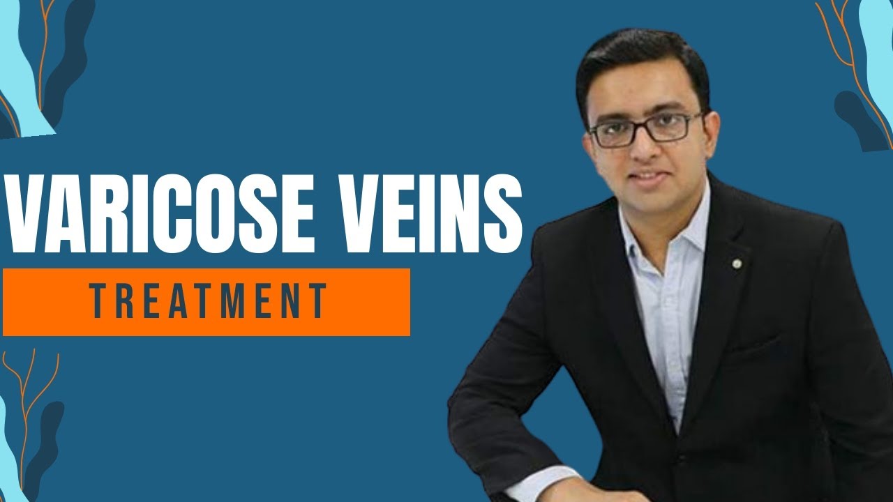 Varicose Veins Treatment | Examination | Exercise | Removal Treatment Varicose Veins