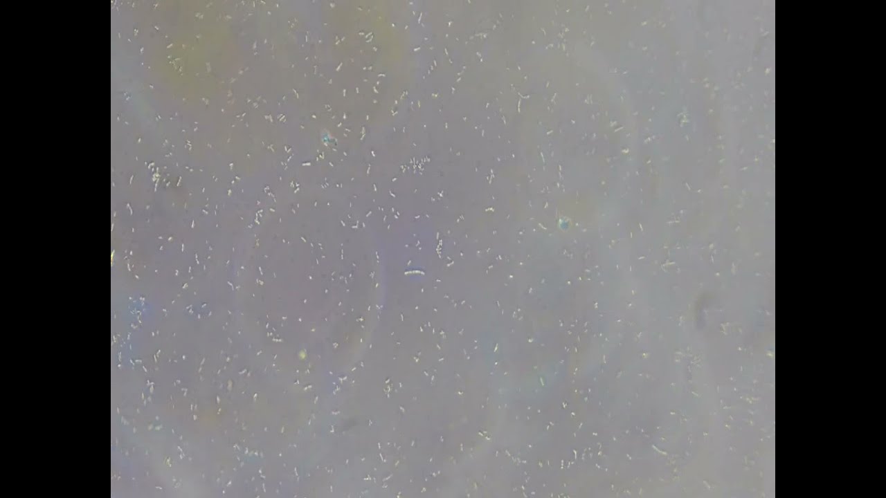 Under microscope: yogurt bacteria in water