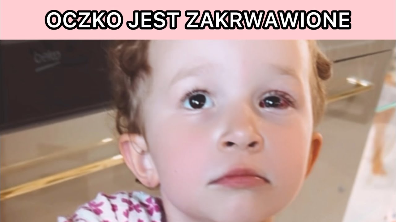 LYRA OTWORZYŁA OCZY