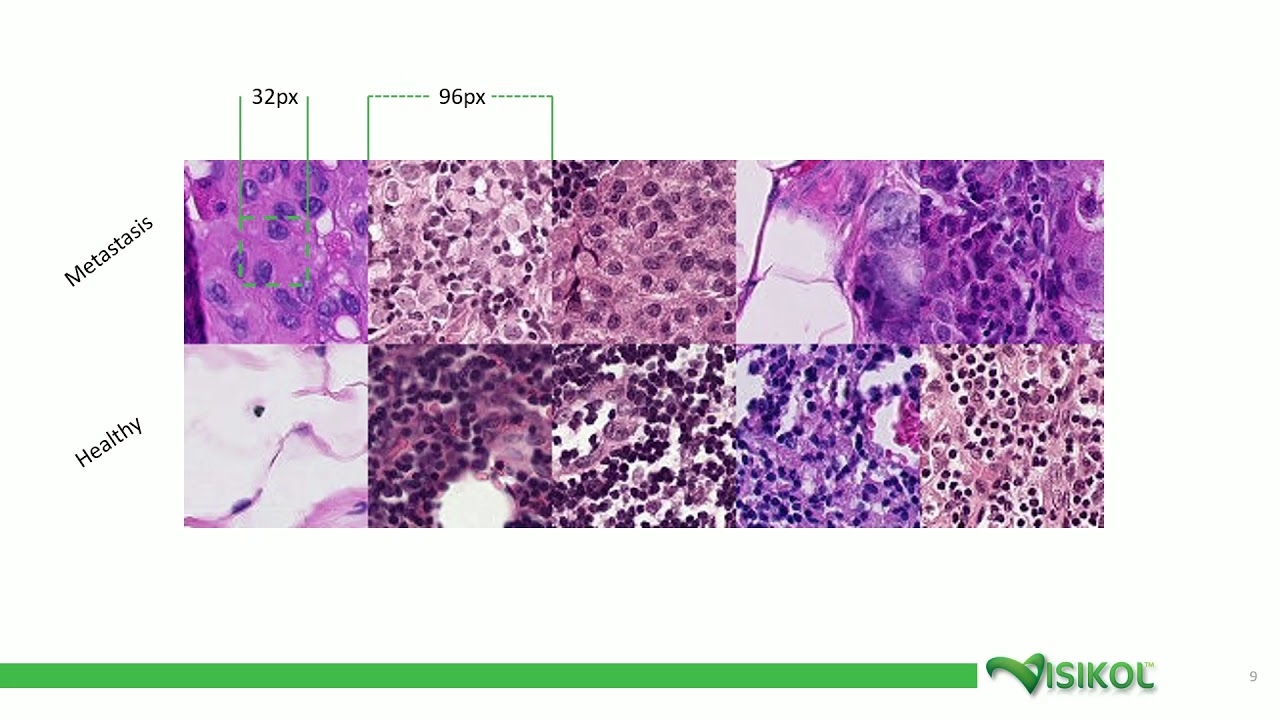 Detecting Tumor Regions using Convolutional Neural Networks