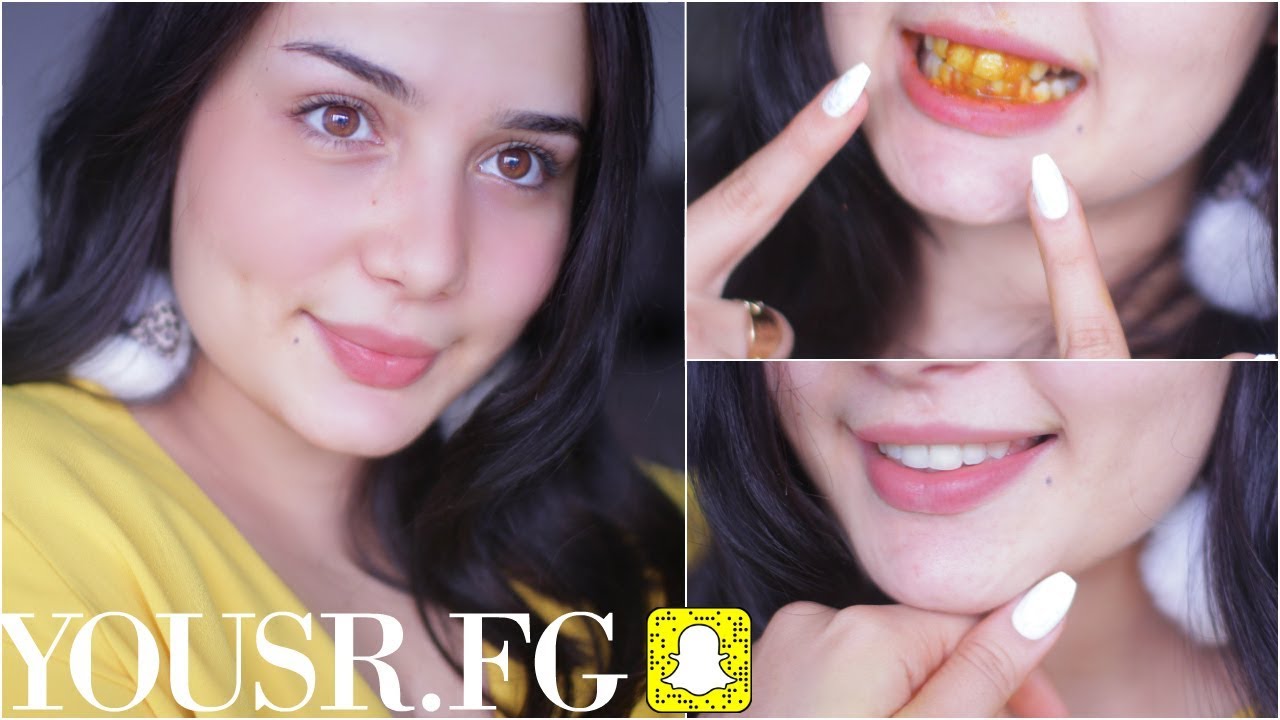 وصفة طبيعية فعالة جدا لتبييض الاسنان | Whiten Your Teeth INSTANTLY