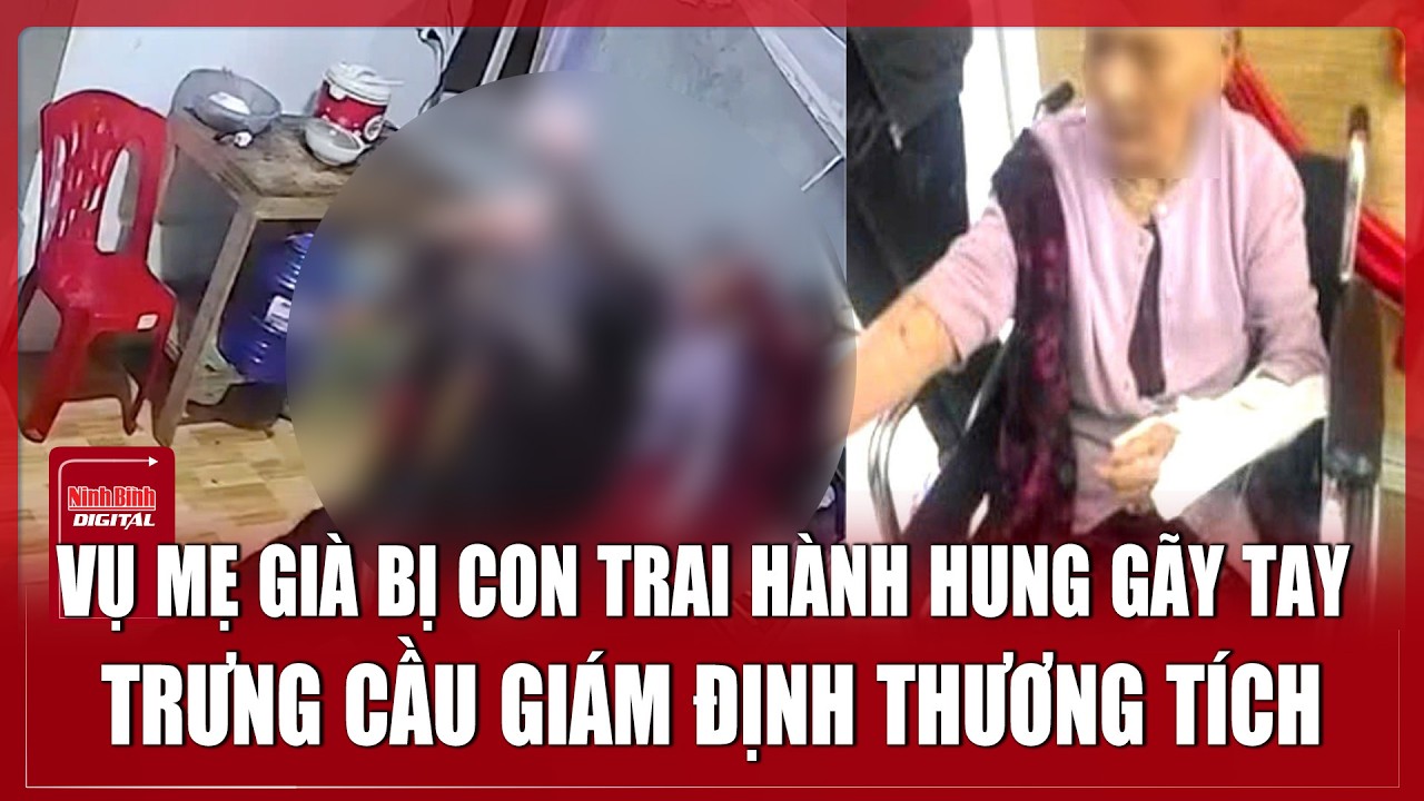 Vụ con trai “tác động vật lý” gãy tay mẹ già tối mùng 3 Tết: Trưng cầu giám định thương tích