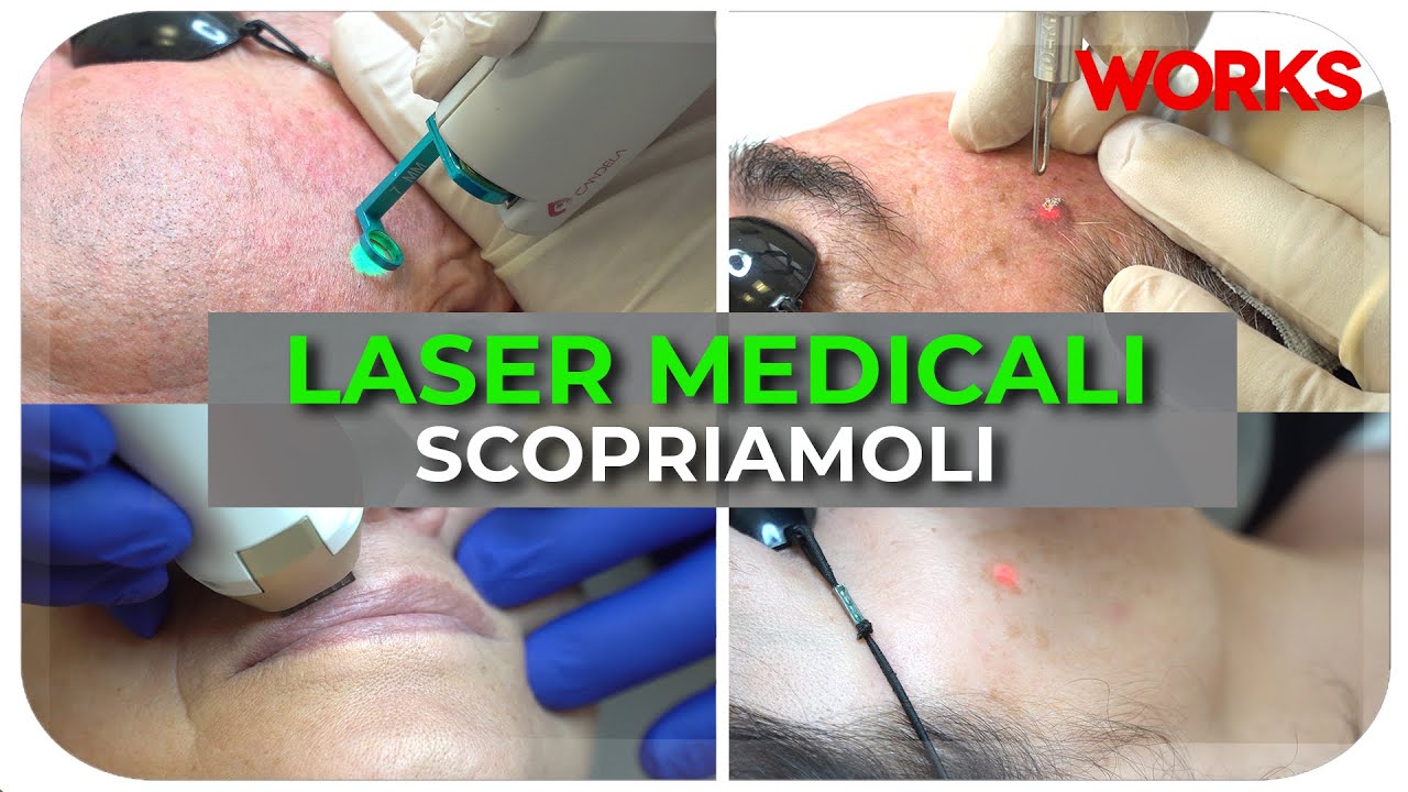 LASER MEDICALI: scopriamoli