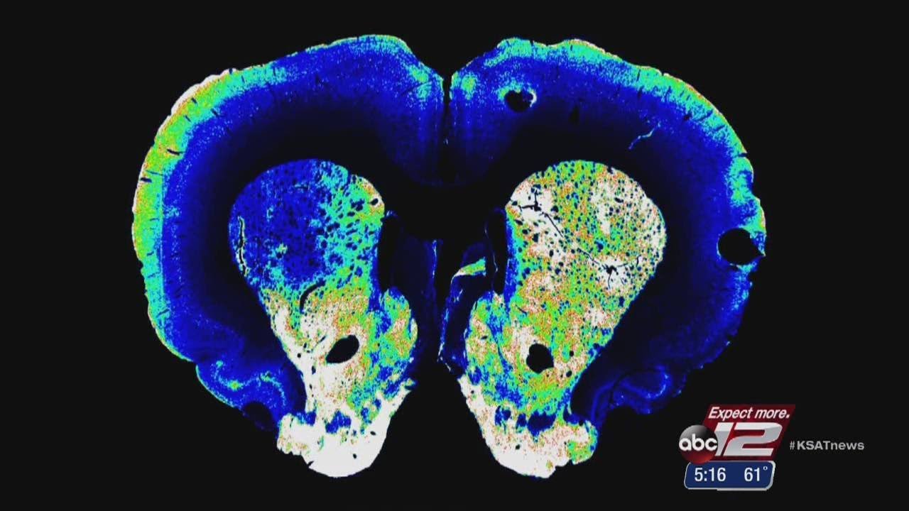 Research show prevention of Parkinson&rsquo;s disease in animals, hopeful it will lead to cure in humans